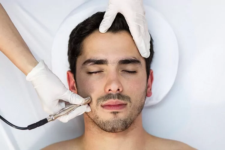 میکرودرم ‌ابریژن برای مردان