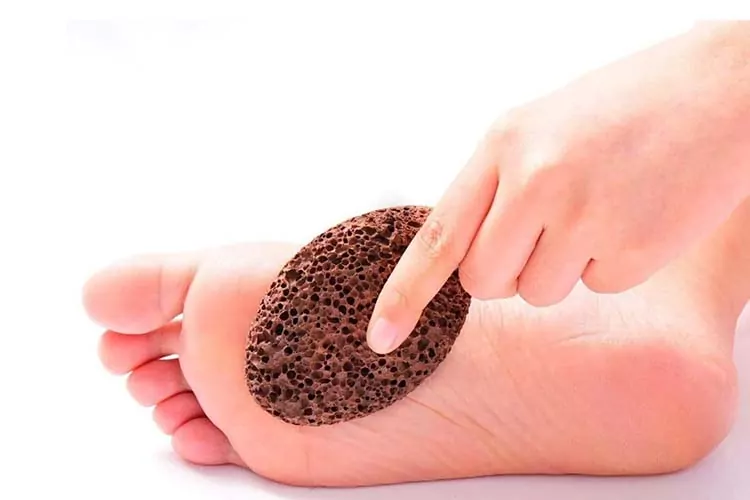 از بین بردن میخچه‌های پوستی و زگیل کف پا