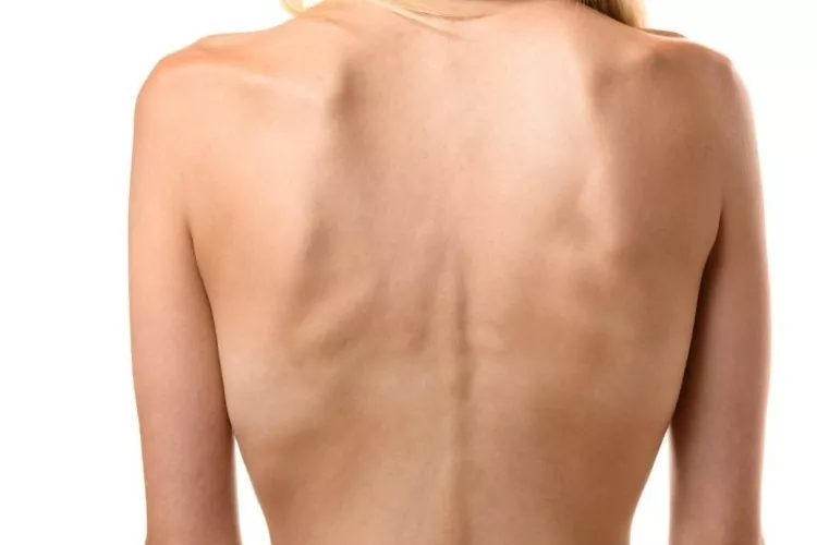 عوامل تاثیرگذار به کاهش وزن شدید_1