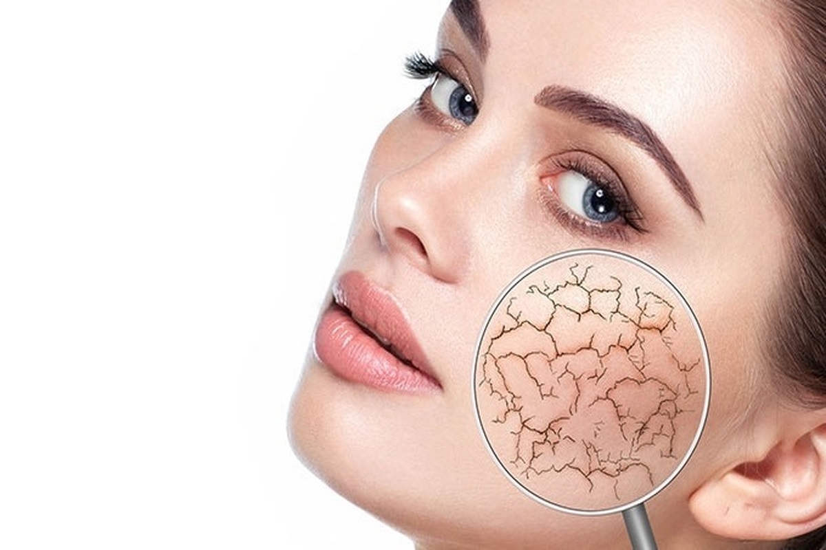 ویژگی‌های پوست خشک و حساس